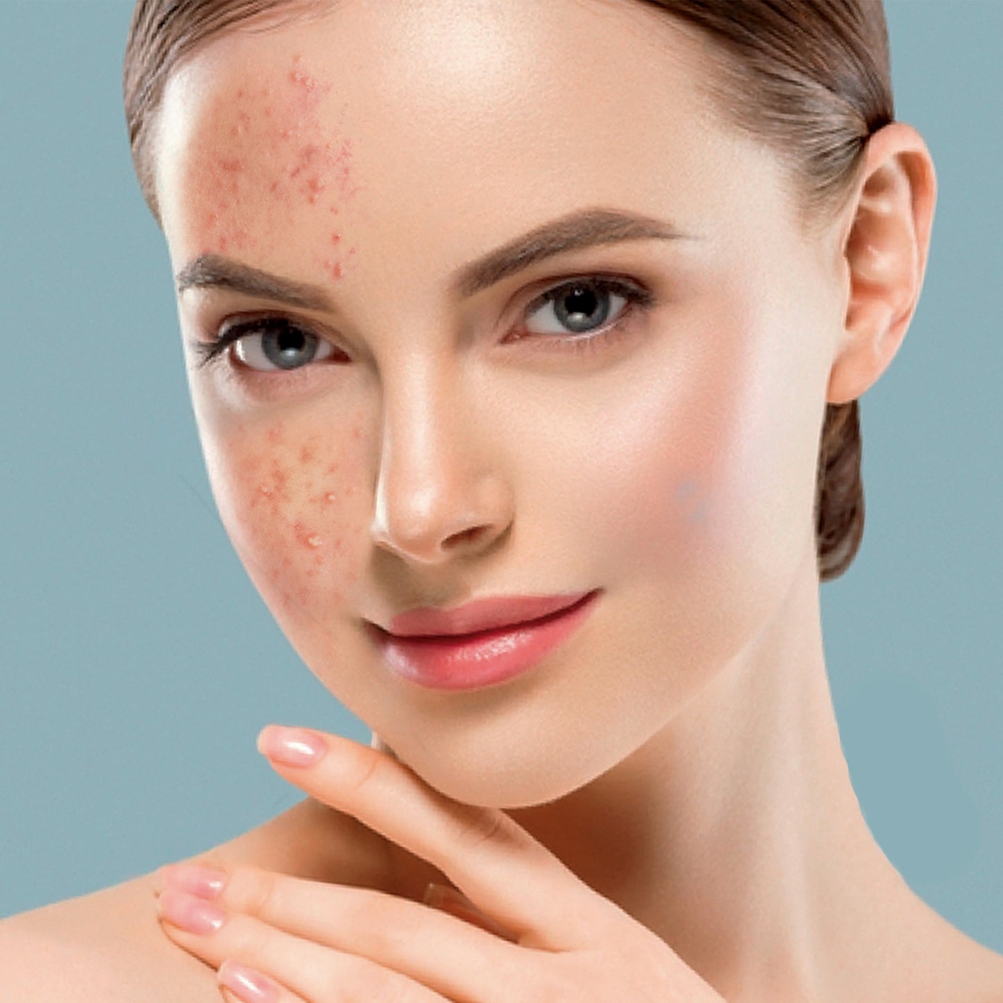 Dermo Clear Activated Carbon Scrub 150 ML | Exfoliante Facial