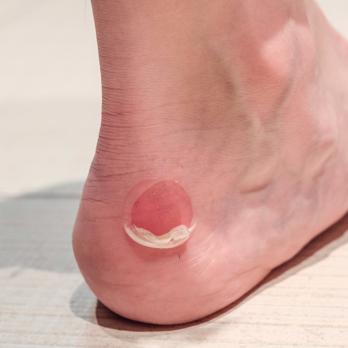 Blister Care 4 Parches | Parches de Gel Protectoras para Roces