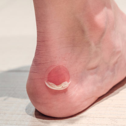 Blister Care 4 Parches | Parches de Gel Protectoras para Roces