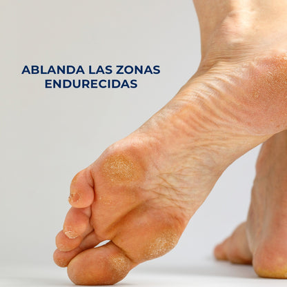 Callus Remover 150 ML | Crema ablandadora de callos