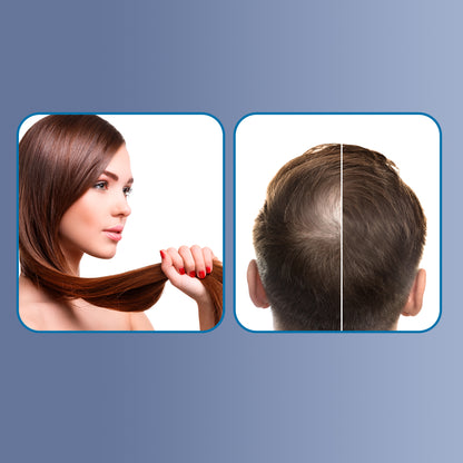 Fortify Max Shampoo Cola de Caballo 300 ML | Shampoo fortalecedor para caída del cabello