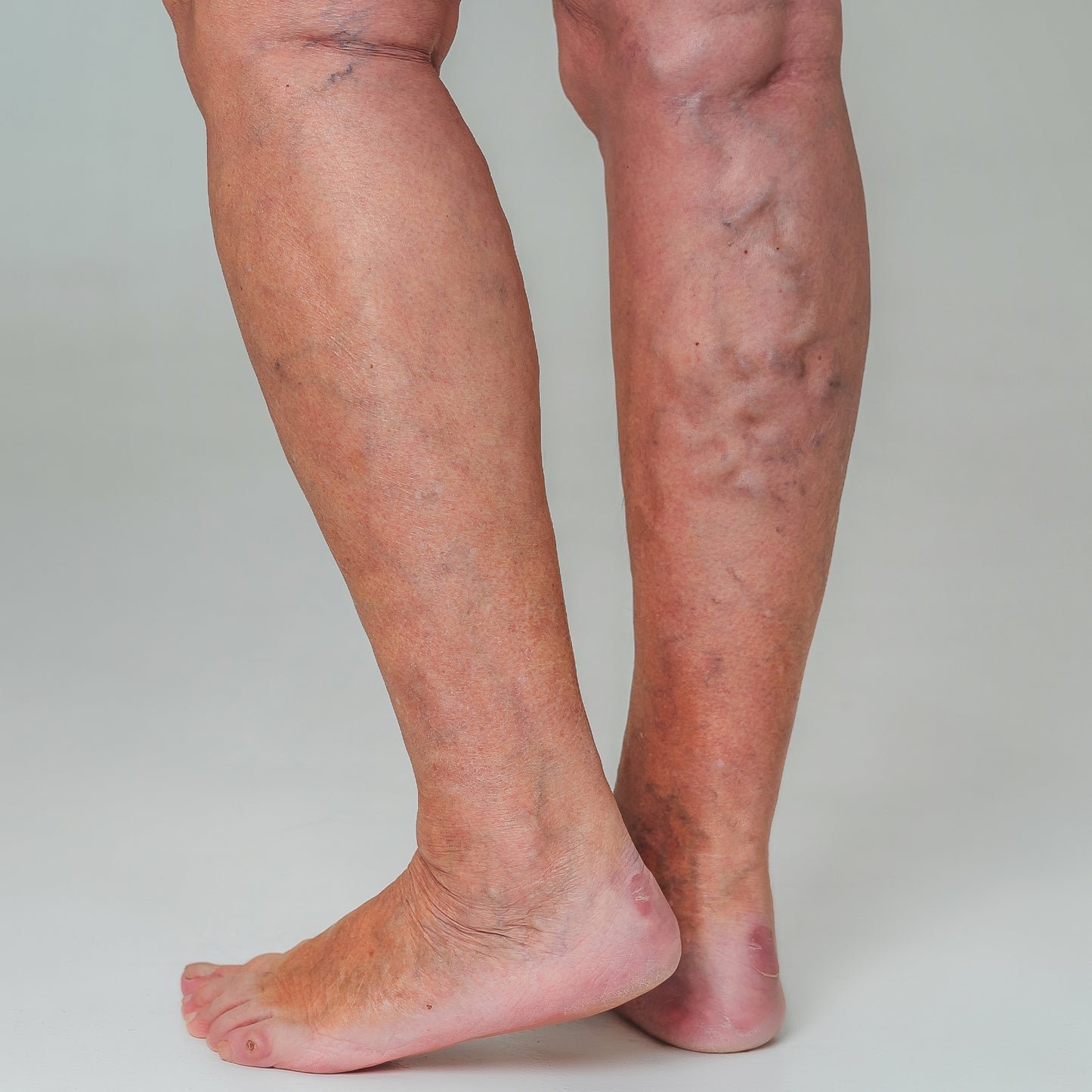 Rested Legs Natural Care Collection 200 ML | Gel para pies y piernas cansadas