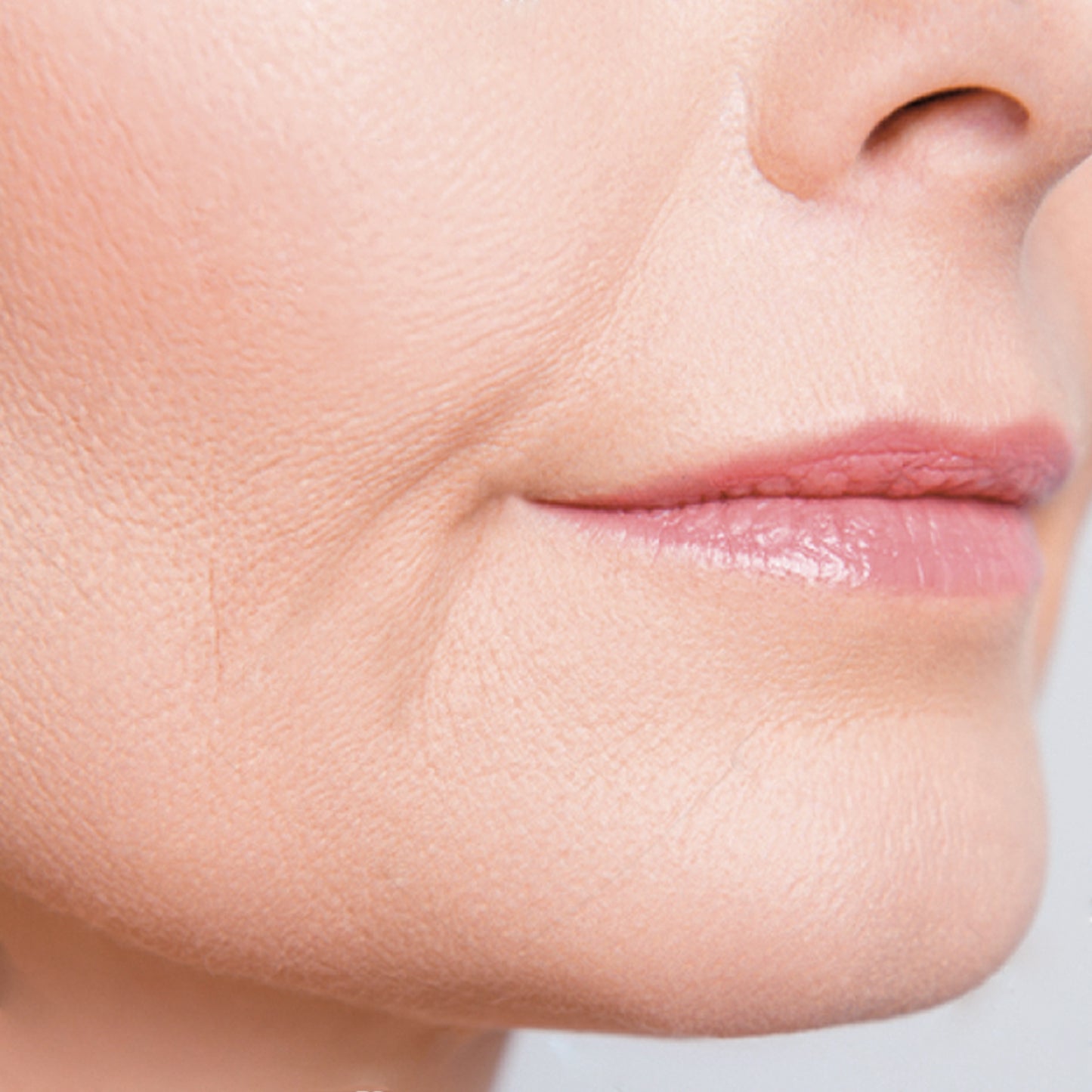Suero Facial Kiotis Hyalucare 30 ML | Suero facial rellenador de arrugas